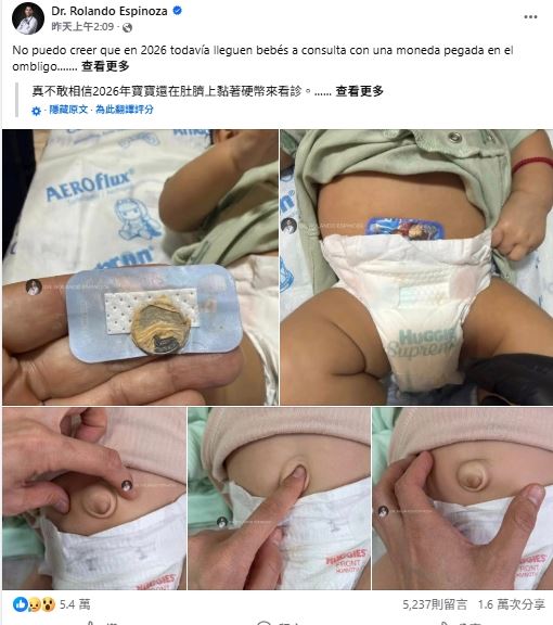 墨西哥醫師羅蘭多（Dr.RolandoEspinoza）在臉書分享案例，吸引5.4萬人按讚1.6萬次分享。（圖／翻攝自Dr. Rolando Espinoza臉書）