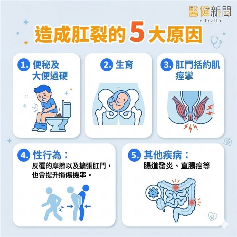 排便如刀割可能是肛裂導致！造成肛裂的5大成因一次解析。（圖／醫健新聞網提供）