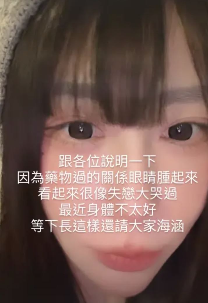 梓梓藥物過敏導致眼睛腫。(圖/翻攝自IG)