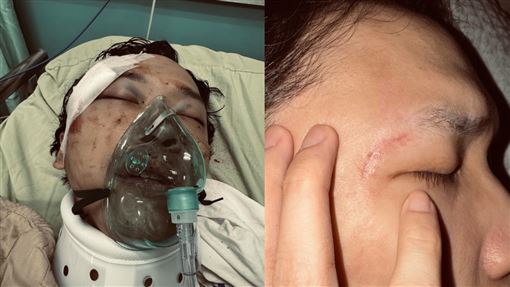 豆腐媽媽臨演出院1月無法睜眼：民視在哪