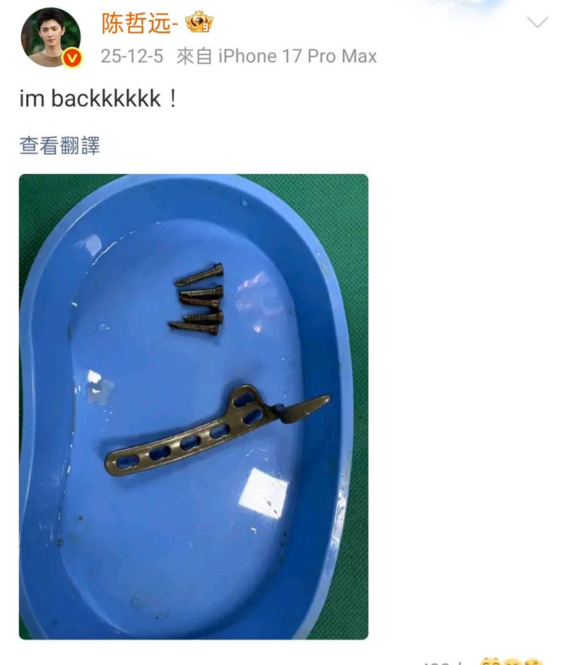 陳哲遠去年底才取出鋼釘。(圖/翻攝自微博)