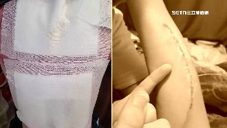 明星國中爆攻擊　生控遭同學過肩摔、踢背