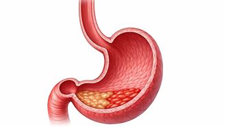 年奪2千命 胃癌元凶是它 「2習慣」害中鏢