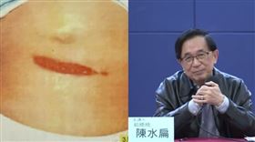 陳水扁今再曝受傷照，嘆如果22年前他死於319槍擊案，還有後來的馬英九、蔡英文跟賴清德嗎（組合圖）