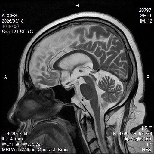 陳文茜公布腦部X光照。（圖／翻攝自臉書）