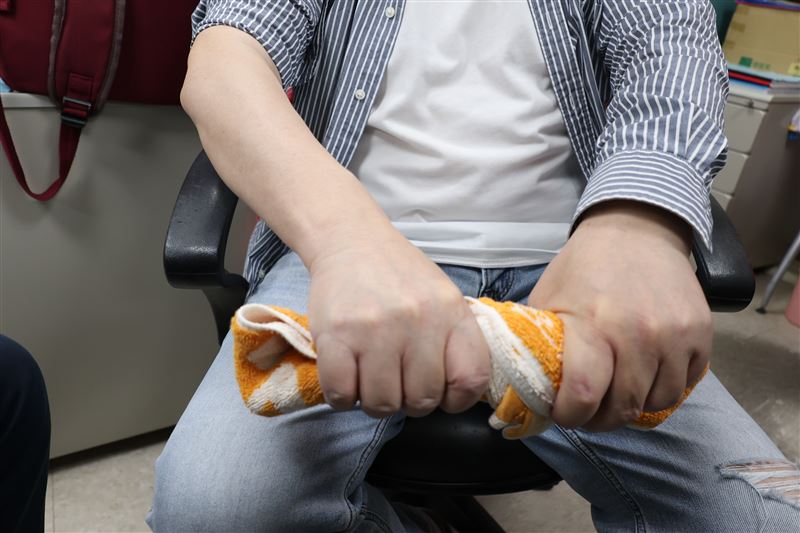 51歲男子右手肘刺痛一年，扭毛巾、拿重物都會感覺疼痛，嚴重到無力拿起咖啡杯，就醫確診高爾夫球肘（圖／衛福部彰化醫院提供）