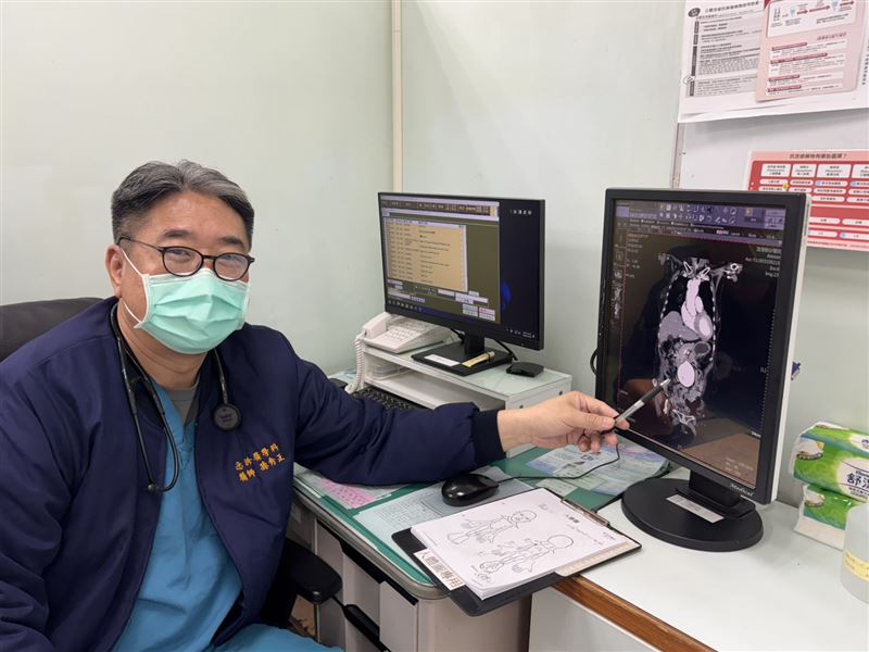 86歲嬤左下肢疼痛又腰痠，症狀持續一週，就醫檢查發現腹部竟有一顆超大血管瘤。(圖／中港澄清醫院提供)