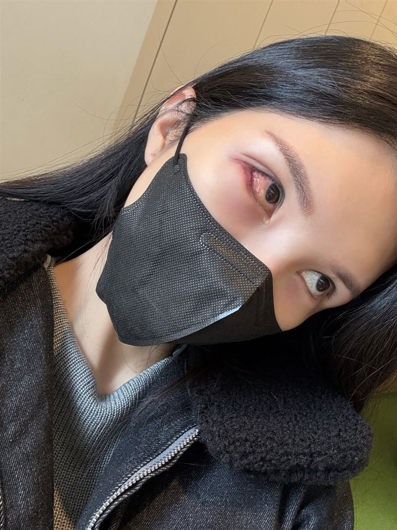 國光女神Lala（蘇心甯）輕忽小小針眼，最後惡化成蜂窩性組織炎。（圖／翻攝自IG @lalababy625）