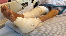 8旬嬤下田，遭3惡犬攻，全身200傷口，驚恐還原，遭攻擊撲咬：爬起來已經不像人，埤頭(圖／翻攝畫面)