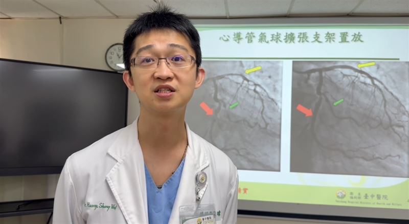34歲男子有3高病史,3條心臟主要血管都出現阻塞,幸好及時就醫接受支架放置手術。(圖/署立臺中醫院提供)