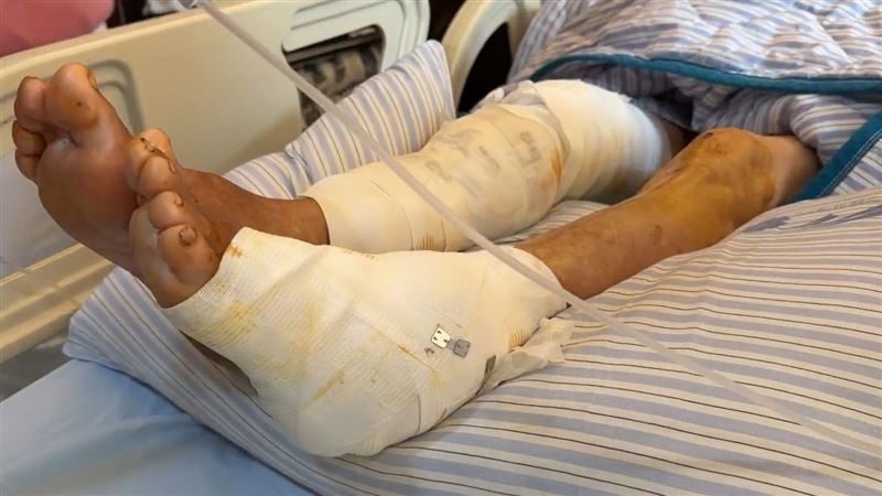 3犬瘋咬76歲嬤200處傷險死!飼主恐關3年