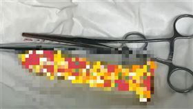 中年男稱「不慎坐到」假陽具滑入肛門！硬拖3天不就醫　慘腸穿孔急開刀（圖／翻攝自網路）