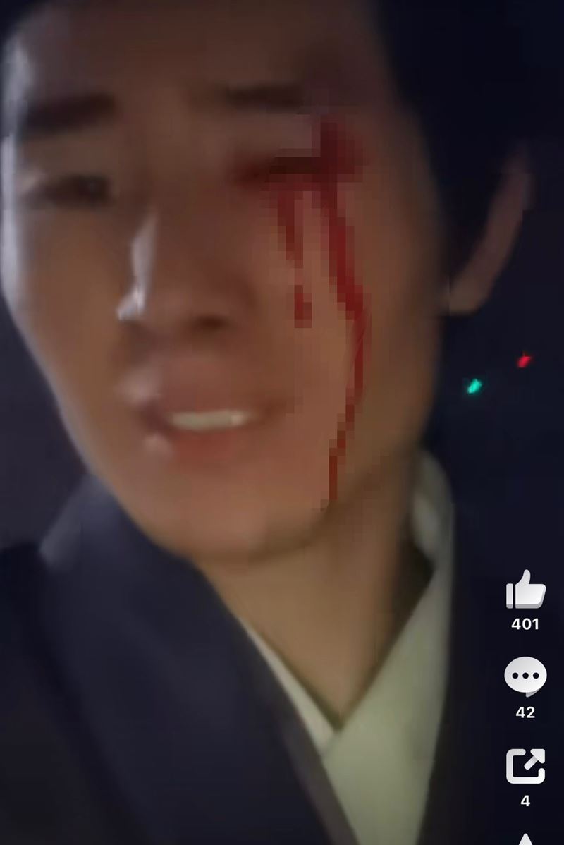 李昀銳新劇臨演傳出遭砸傷。（圖／翻攝自微博）