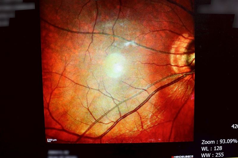 許多壯年自認「能吃能跑就健康」,卻可能已高血糖或高血脂。聯新國際醫院新陳代謝科主治醫師黎裕昌提醒,成人健檢可揪出無症狀糖尿病,及早控制可避免失明、腎病與神經併發症。(圖/聯新國際醫院提供)