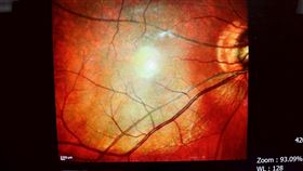 聯新國際醫院成人健檢揪血糖暗箭！里民主動出擊及早投資健康。（圖／聯新國際醫院提供）