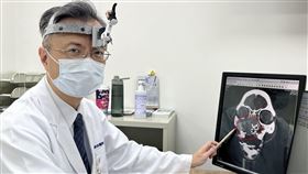 90歲婦人，鼻腔反覆大量流血，三度求醫，竟是罕見假性動脈瘤(圖／光田綜合醫院提供)