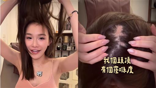 網紅認愛已婚富商　摘假髮驚見「鬼剃頭」