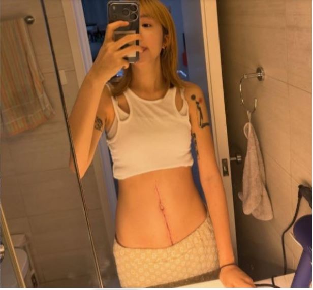 曉欣接受手術切除了14公分的腫瘤。（圖／翻攝自IG）