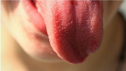 愛漱口舌頭竟「發霉」！醫：過度恐發炎