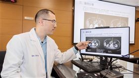 術前化療結合擴大切除　胰臟癌提高存活率成大醫院外科部醫師廖亭凱10日表示，胰臟癌多數病人確診時已屬局部晚期或轉移期，「術前化療」結合「擴大切除」整合治療策略，明顯延長整體存活期。（成大醫院提供）中央社記者張榮祥台南傳真　114年12月10日