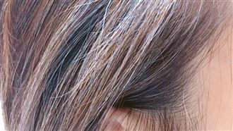 少年白髮竟是營養失調　補5類食物黑回來