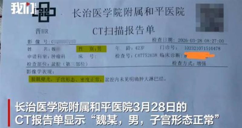 山西一名男性患者電腦斷層（CT）報告出現「子宮形態正常」字樣，引發關注。（圖／翻攝自江蘇新聞）