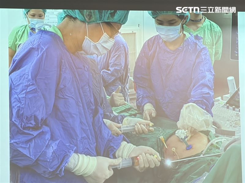 呂小姐接受「胎兒內視鏡脊柱裂修補微創手術」。（圖／記者簡浩正攝影）