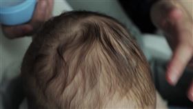 我孩子掉頭髮正常嗎？家長必備初步判斷指南一次看　醫揭照護「3關鍵」。（圖／醫健新聞網提供） 