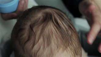 我孩子掉頭髮正常嗎？醫揭照護「3關鍵」