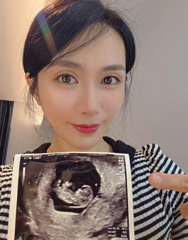 許鈞鈞懷孕已滿三個月。（圖／翻攝自許鈞鈞臉書）