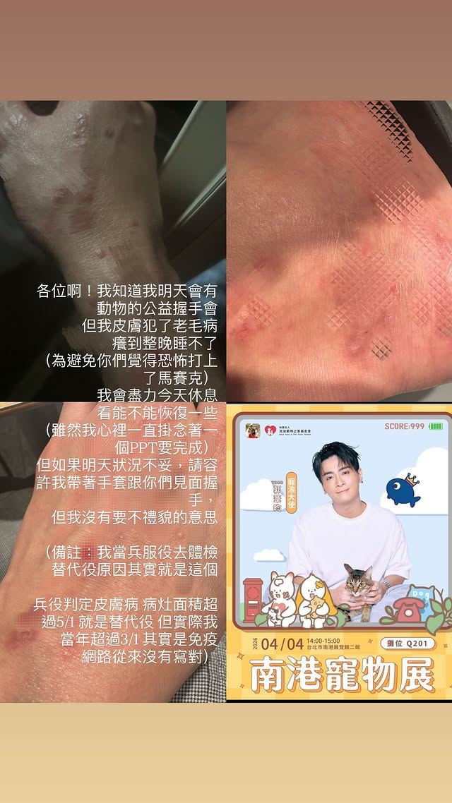 Toro罹患皮膚病免役，但仍完成替代役。（圖／翻攝自Toro IG）