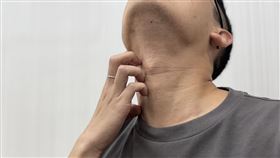 清明濕氣上升濕疹好發隨著清明節氣來臨，氣候由乍暖還寒逐漸轉為溫暖潮濕，中醫師指出，此時正是皮膚問題好發季節，尤其是濕疹、異位性皮膚炎、皮膚搔癢等症狀。中央社記者沈佩瑤攝　115年4月4日