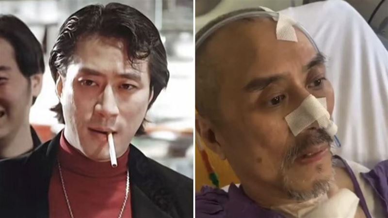 《古惑仔》軍師離世 生前憔悴住院照流出