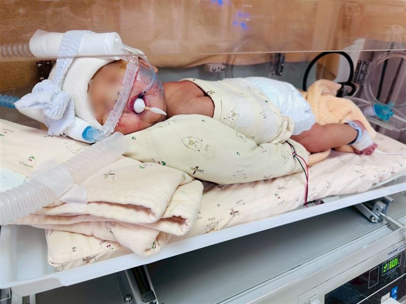 男嬰罹患「先天性肺炎」,屬於新生兒嚴重的感染性疾病之一。(圖/烏日林新醫院提供)