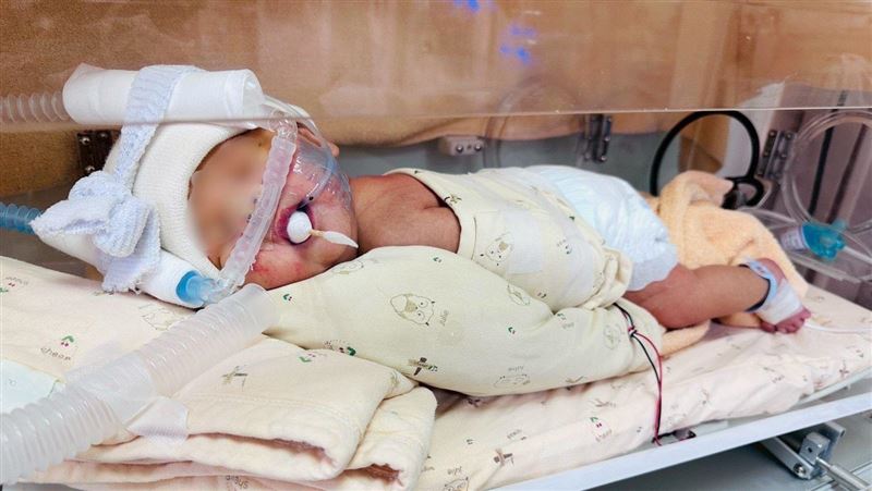 男嬰出生哭兩聲就不動了!竟是先天性肺炎