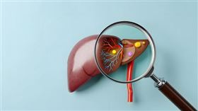 脂肪肝可以好嗎？營養師揭「8大類」護肝食物、「5招」遠離脂肪肝。（圖／醫健新聞網提供） 