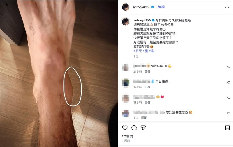 郭彥均日前進行長距離單車騎乘訓練,運動結束後,他卻發現右腳踝出現異常腫脹,而且3天都未改善。(圖/翻攝自郭彥均IG)
