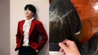 薛之謙頭皮灼傷硬撐　「滿頭水泡」慘況曝