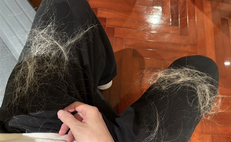 薛之謙頭髮狂掉。（圖／翻攝自小紅書）