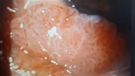 菜花,眼科,性行為,性伴侶