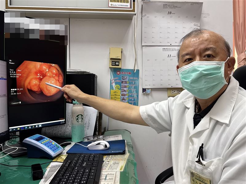 賴大豊醫師指出，婦人出現腹部脹痛、大便不成形的症狀，全因腫瘤塞在腸內導致。(圖／大甲李綜合醫院提供)
