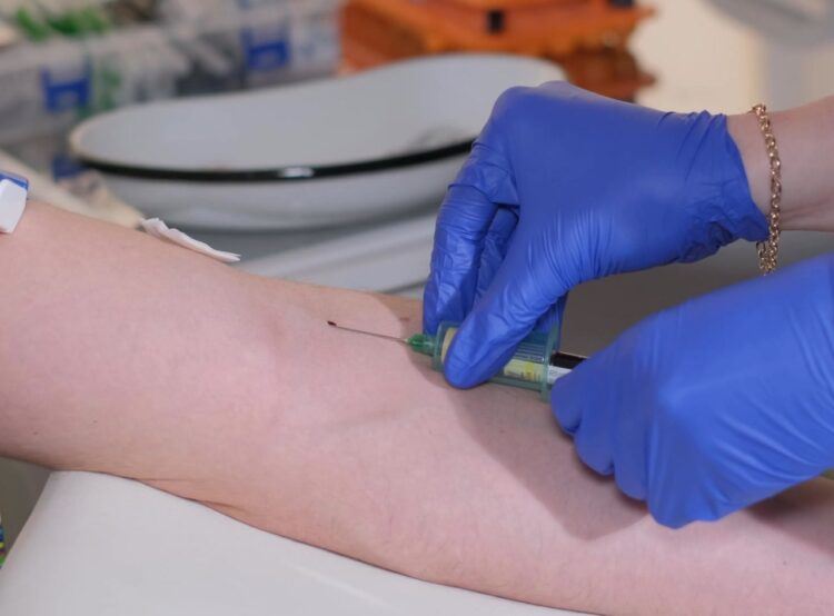 B肝帶原者能吃保健食品？營養師盤點「4大」傷肝成分、挑選「3原則」！（圖／醫健新聞網提供）