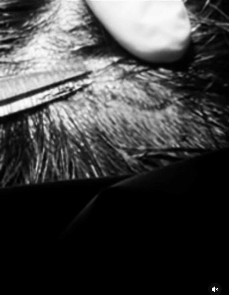 詹子晴傷勢曝光。(圖/翻攝自IG)