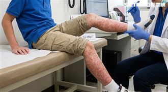 男童發燒「整腳紅疹又痛」 一查父母痛哭