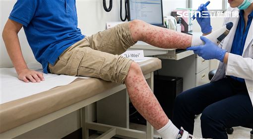 男童發燒「整腳紅疹又痛」 一查父母痛哭