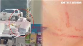 肋骨,神經病,臉頰,爪痕,3寶媽,寶雅,高雄,路竹（圖／翻攝畫面）