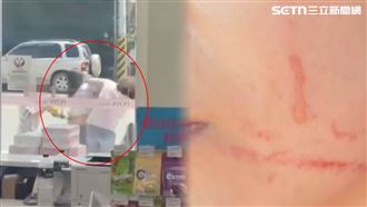 3寶媽vs婦…掌摑、肋骨血爪痕！導火線曝