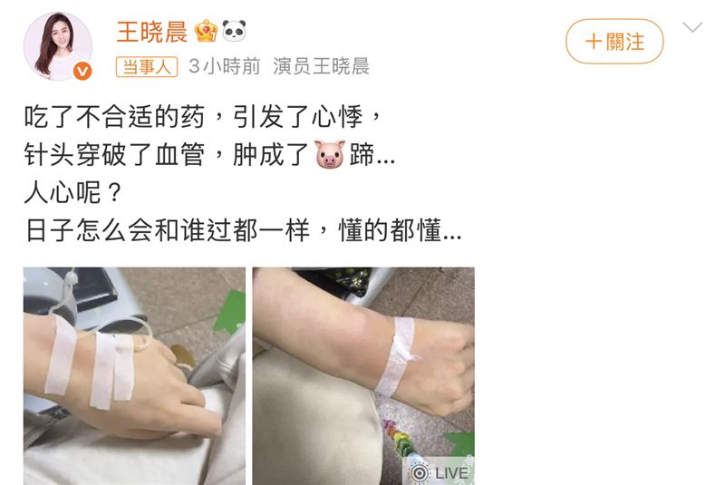 王曉晨服藥後心悸送醫。(圖/翻攝自微博)