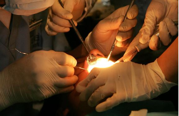 英國男子帕維爾赴土耳其進行全口植牙，治療失敗以後不堪痛苦輕生身亡。（示意圖／pexel）