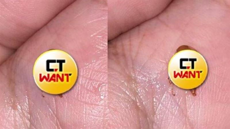 男友咳出「詭異生物」 全網見畫面抖爆